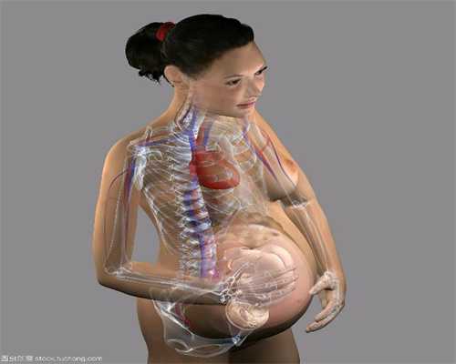 妊娠期糖尿病对母婴的影响_iui助孕
