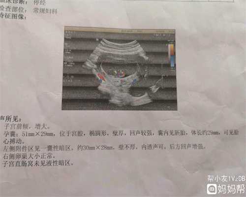上海代孕网哪家机构好：模特分娩时刻才知代孕