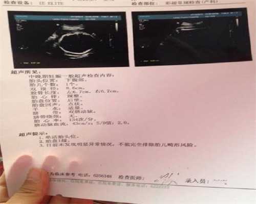 上海生殖代孕：继发性不孕？可以通过美国试管