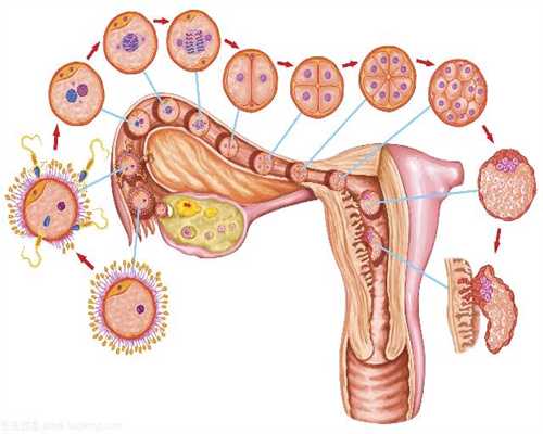 潍坊代孕机构：卵巢囊肿将近十个厘米必须手术