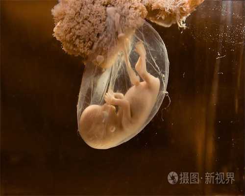 北京代孕公司:7个月女婴输尿管狭窄反复发烧，“