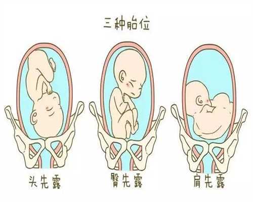 临汾代孕_临汾供卵代怀孩子_在上海九院移植成功