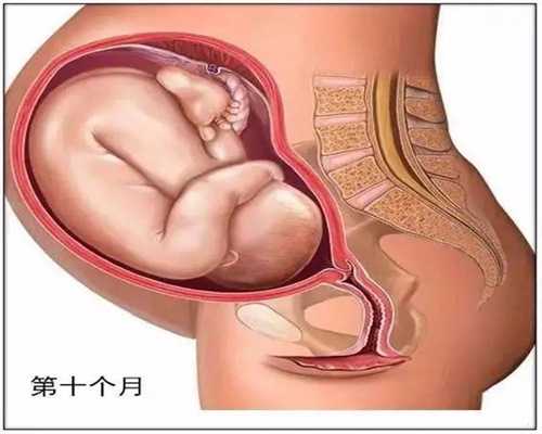 遵义代孕双胞胎哪些风险_遵义输卵管通液差点疼