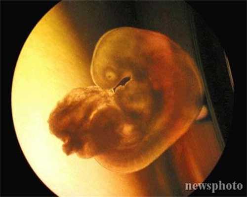 深圳中美代孕·借卵试管是亲生的吗·卵巢早衰患