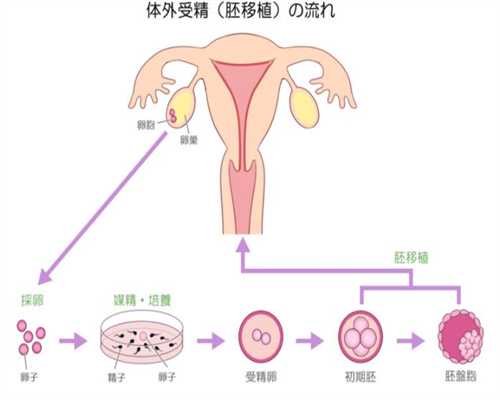 上海为老公代孕·上海广受好评的代孕保成功·多