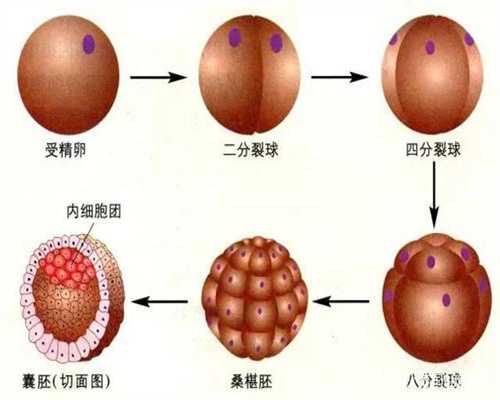 先天性卵巢发育不全的染色体核型是~供卵试管孩
