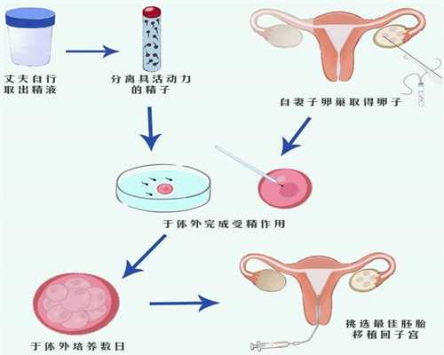 先天性卵巢发育不全 的染色体_国内最好供卵机构