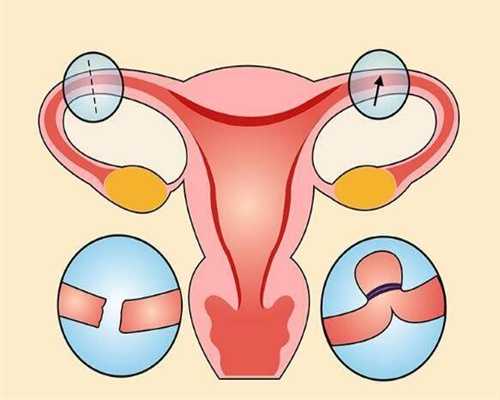 先天性卵巢发育不全综合征怎么治疗方法_第一试
