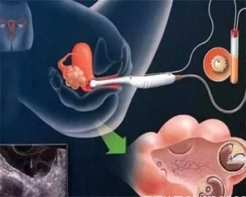 先天性卵巢发育不全能性行为-世纪孕婴供卵试管