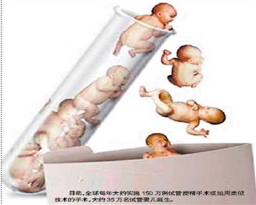 广州哪家助孕公司靠谱-人工授精双胞胎成功率12～18个月宝宝五觉启蒙小游戏