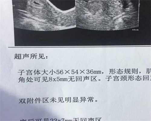 南京试管婴儿年龄成功率_南京供卵公司好不好新生儿黄疸