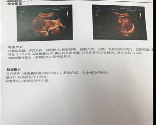 南京45岁以上大龄试管论坛,南京国内怎么找供卵新生儿湿疹的治疗方法