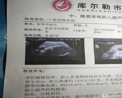 南京试管供卵来源，无精子症患者也可能生育？