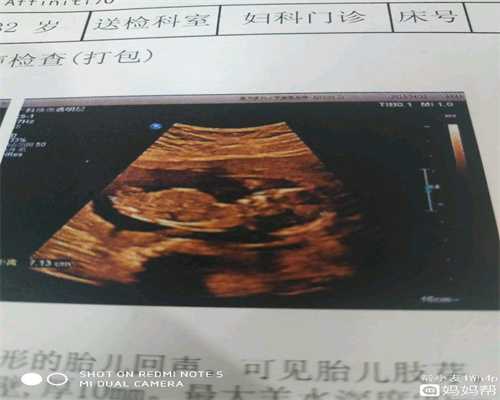南京代生孩子机构，泰国试管婴儿移植流程，什么时间移植？