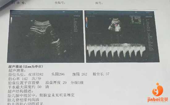 广东哪有供卵机构,【广州有哪些供卵机构】11月5号预产期，由于头胎剖腹产